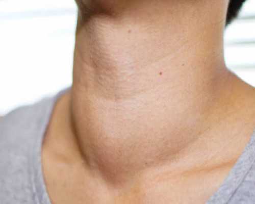 试管精子筛选技术介绍