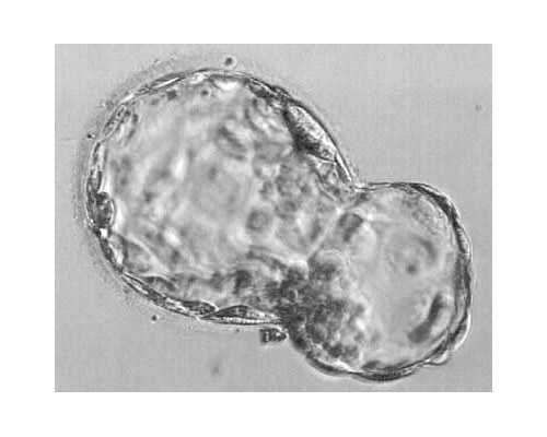 试管保胎中黄体的作用