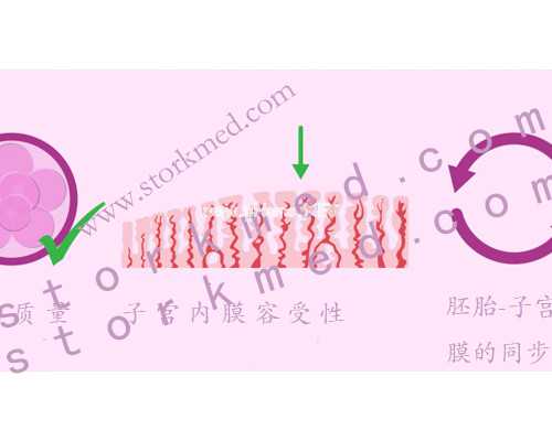 借鉴试管婴儿成功案例，开启你的生育之旅