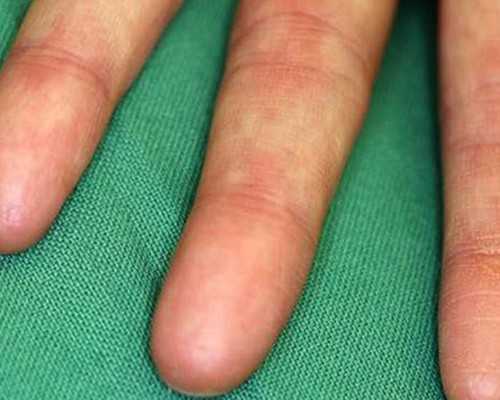 试管婴儿二代好还是三代好