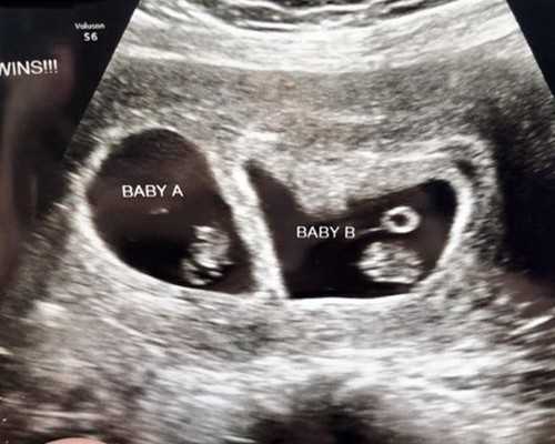 北京靠谱代生中心,新冠疫苗从打一针到吸一口，啥感觉？北京市民：有点儿甜