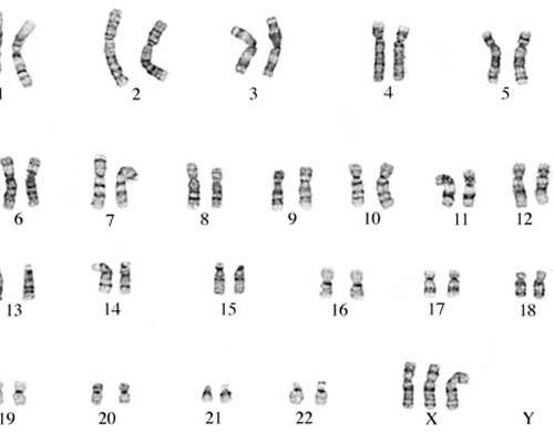牙齿痛有松动怎么办,儿童牙齿痛有松动怎么办