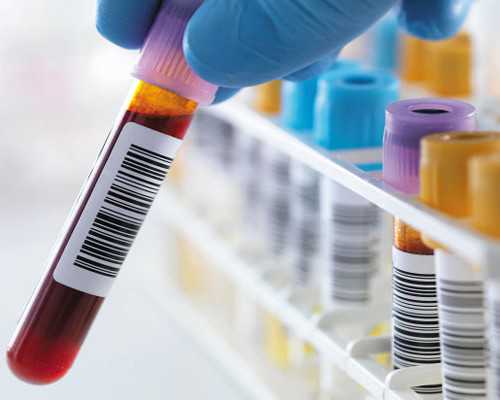 宝宝口腔溃疡的原因