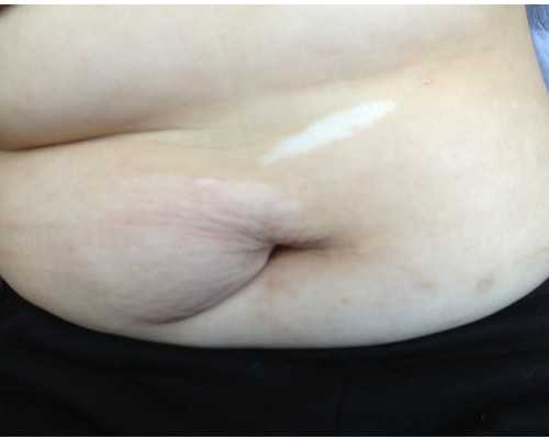 广州三大助孕公司是哪些？附价格明细表!