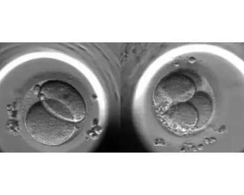 试管精子活力低怎么办？