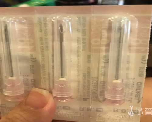 试管精子处理时间