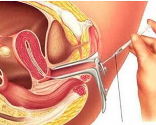 郑州助孕公司排名公布,为好孕而生!