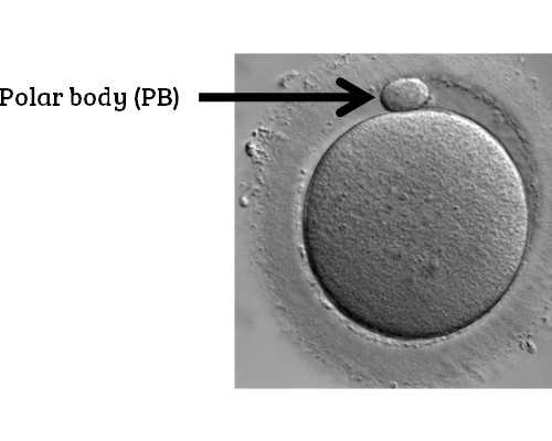 试管胚胎筛查能防畸形吗？