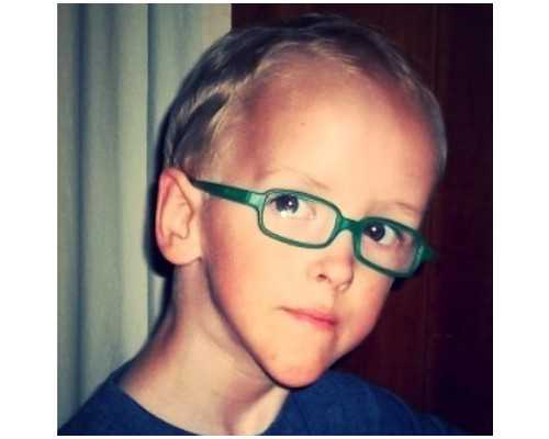 试管技术会导致胎儿畸形吗？