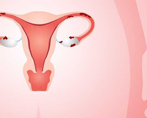 试管移植后防畸关键措施