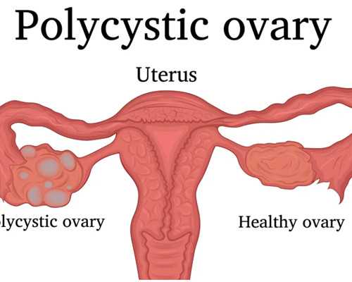 北京正规借卵,北京生殖中心供卵试管婴儿,北京试管婴儿供卵捐卵