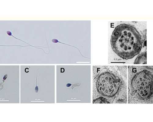 试管失败后如何评估黄体功能状态？