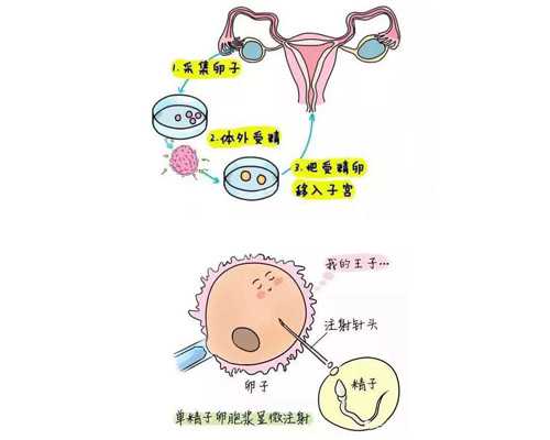 北京有好的代孕公司吗,北京精子库捐献补偿,北京哪里可以捐献精子