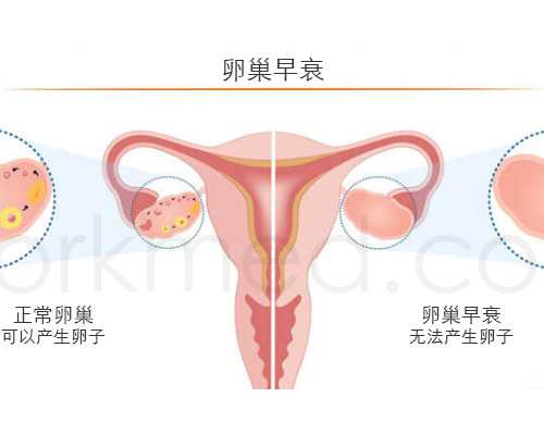 湖北供卵试管不排队医院