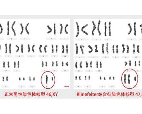北京供卵试管婴儿流程详细解读