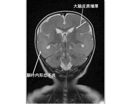 剖析影响试管婴儿成功率的多种因素