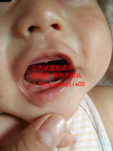供卵自怀的程序_北京私立医院做供卵合法吗_羊膜穿刺术会影响身体吗？